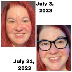 اسنس حلزون کوزارکس (100% اصل+به قیمت پخش) 44 51A MkKV1FL