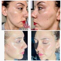 کرم حلزون کوزارکس اصل (به قیمت پخش) مرطوب کننده 18 61Qd5x5965L