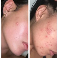 کرم مرطوب کننده سراوی CERAVE حجم 454 گرم | مناسب پوست خشک و بسیار خشک 14 61Rk0mVu7VL