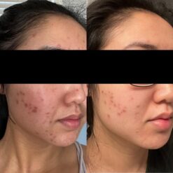 اسنس حلزون کوزارکس (100% اصل+به قیمت پخش) 46 61c46SVrkiL