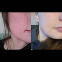 کرم مرطوب کننده سراوی CERAVE حجم 454 گرم | مناسب پوست خشک و بسیار خشک 15 61jhJzFKzzL