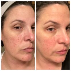 اسنس حلزون کوزارکس (100% اصل+به قیمت پخش) 31 61uAdpQ4WaL