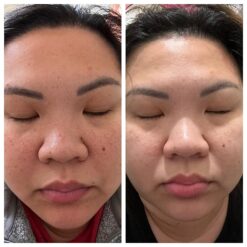 اسنس حلزون کوزارکس (100% اصل+به قیمت پخش) 43 7180n5zfTyL