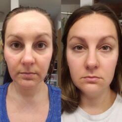 اسنس حلزون کوزارکس (100% اصل+به قیمت پخش) 37 71LlthteNaL