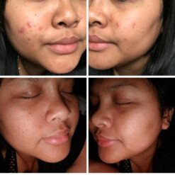 اسنس حلزون کوزارکس (100% اصل+به قیمت پخش) 32 71e1GzRzf8L