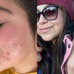 اسنس حلزون کوزارکس (100% اصل+به قیمت پخش) 36 71kG3tKP9uL