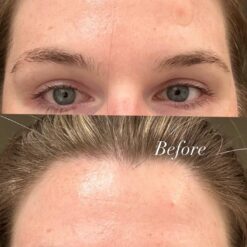 سرم رتینول سراوی پوست چرب و مختلط (100%اصل+به قیمت پخش) آبی ضد جوش 40 71sa3kTuvvL