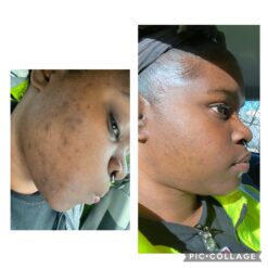 سرم رتینول سراوی پوست چرب و مختلط (100%اصل+به قیمت پخش) آبی ضد جوش 50 9115YUuHKL