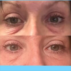 کرم دور چشم سراوی (100%اصل+به قیمت پخش) 21 9d429a71 cf6b 51d9 89e4 cf73c239a28b