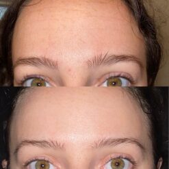 سرم رتینول سراوی پوست چرب و مختلط (100%اصل+به قیمت پخش) آبی ضد جوش 52 A14XvauffYL