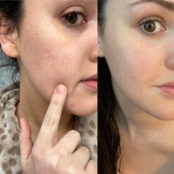 کرم حلزون کوزارکس اصل (به قیمت پخش) مرطوب کننده 13 A1Y0lqOYz6L