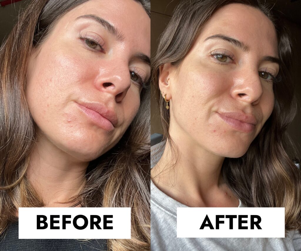 شوینده سراوی پوست چرب و جوش دار (100%اصل+به قیمت پخش) بلمیش ضد جوش 16 BIQ BEFORE AFTER 51