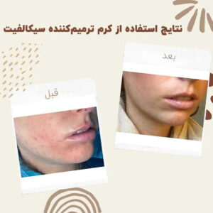 Cicalfate Repair Cream 0011