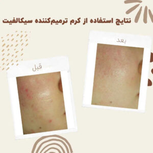 Cicalfate Repair Cream 0012