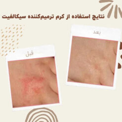 Cicalfate Repair Cream 0013