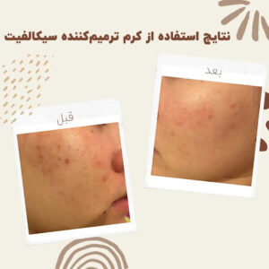 Cicalfate Repair Cream 0014