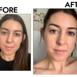 کرم دور چشم سراوی (100%اصل+به قیمت پخش) 23 Ole Henriksen Banana Bright Vitamin C Brightening Eye Creme Before and After 5f9a41489ef34f07b5db151c44cc3c8d