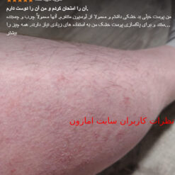 لوسیون سراوی صورت و بدن پوست خشک(اصل+به قیمت پخش) سفارش اروپا 13 Screenshot 188