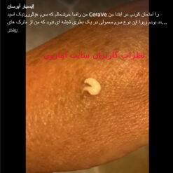 سرم آبرسان هیالورونیک اسید سراوی (100%اصل+به قیمت پخش) سفارش اروپا 18 Screenshot 205