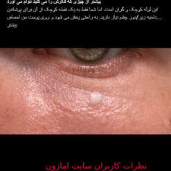 کرم دور چشم سراوی (100%اصل+به قیمت پخش) 28 Screenshot 218