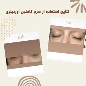 before after Caffeine 3 min