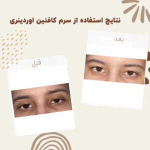 before after Caffeine 4 min