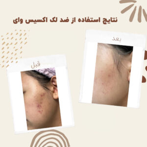 before after axis y 3