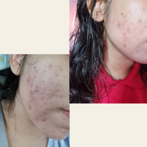 before after axis y 4 1