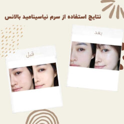 سرم نیاسینامید بالانس (100%اصل+به قیمت پخش) 8 before after balance niacinamide 2