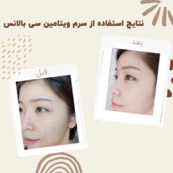 سرم ویتامین سی بالانس (100%اصل+به قیمت پخش) 7 before after balance vitaminc serum 3