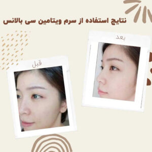 before after balance vitaminc serum 3