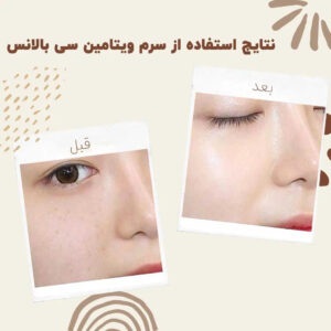 before after balance vitaminc serum 4
