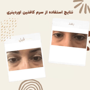 before after cafeen 1