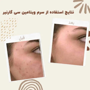 before after garinier bright vitamin serum 01 min