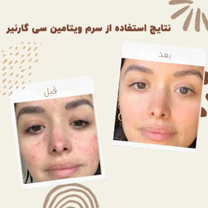 before after garinier bright vitamin serum 03 min