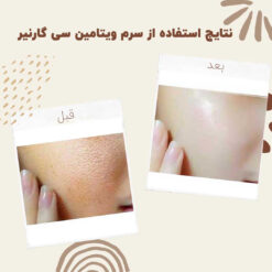 سرم ویتامین سی گارنیر (100%اصل+به قیمت پخش) آبرسان 10 before after garnier vitamin c 2 min