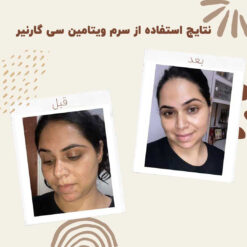 سرم ویتامین سی گارنیر (100%اصل+به قیمت پخش) آبرسان 9 before after garnier vitamin c 3 min
