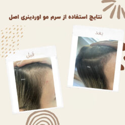 سرم ضد ریزش مو اوردینری مولتی پپتید (100%اصل+به قیمت پخش) 37 before after hair oridinary 1