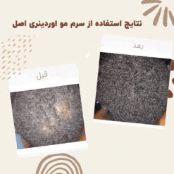 سرم ضد ریزش مو اوردینری مولتی پپتید (100%اصل+به قیمت پخش) 28 before after hair oridinary 10