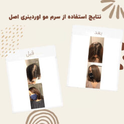 سرم ضد ریزش مو اوردینری مولتی پپتید (100%اصل+به قیمت پخش) 27 before after hair oridinary 11