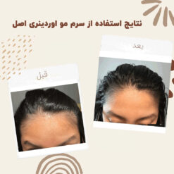 سرم ضد ریزش مو اوردینری مولتی پپتید (100%اصل+به قیمت پخش) 26 before after hair oridinary 12