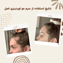 سرم ضد ریزش مو اوردینری مولتی پپتید (100%اصل+به قیمت پخش) 25 before after hair oridinary 13