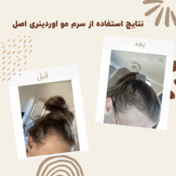 سرم ضد ریزش مو اوردینری مولتی پپتید (100%اصل+به قیمت پخش) 24 before after hair oridinary 14