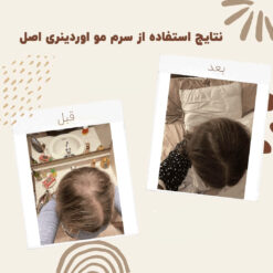 سرم ضد ریزش مو اوردینری مولتی پپتید (100%اصل+به قیمت پخش) 23 before after hair oridinary 15