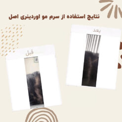 سرم ضد ریزش مو اوردینری مولتی پپتید (100%اصل+به قیمت پخش) 22 before after hair oridinary 16