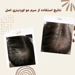 سرم ضد ریزش مو اوردینری مولتی پپتید (100%اصل+به قیمت پخش) 21 before after hair oridinary 17