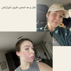 اسنس حلزون کوزارکس (100% اصل+به قیمت پخش) 30 before after hair oridinary 18 510x510 1