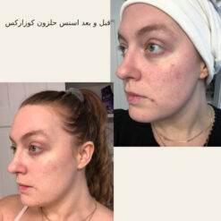 اسنس حلزون کوزارکس (100% اصل+به قیمت پخش) 29 before after hair oridinary 18 510x510 2