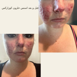 اسنس حلزون کوزارکس (100% اصل+به قیمت پخش) 28 before after hair oridinary 18 510x510 3