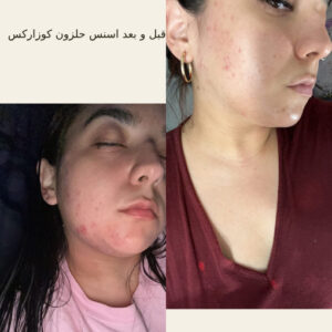 before after hair oridinary 18 510x510 4